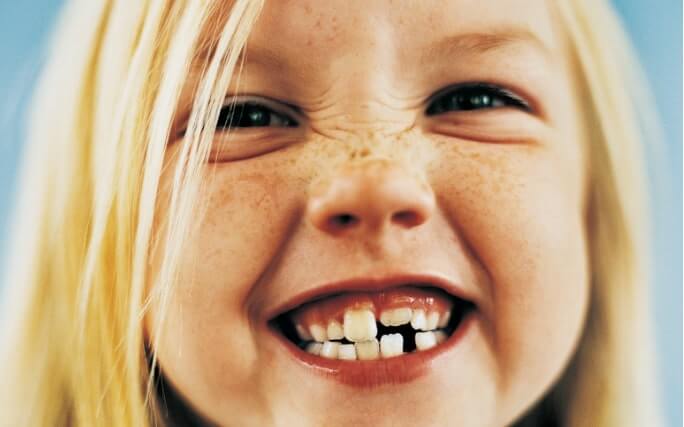 5 razoes porque precisa de um seguro de saude com medicina dentaria